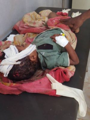 استشهاد طفل وإصابة ثلاثة آخرين بقصف حوثي على منطقة شمير غرب تعز
