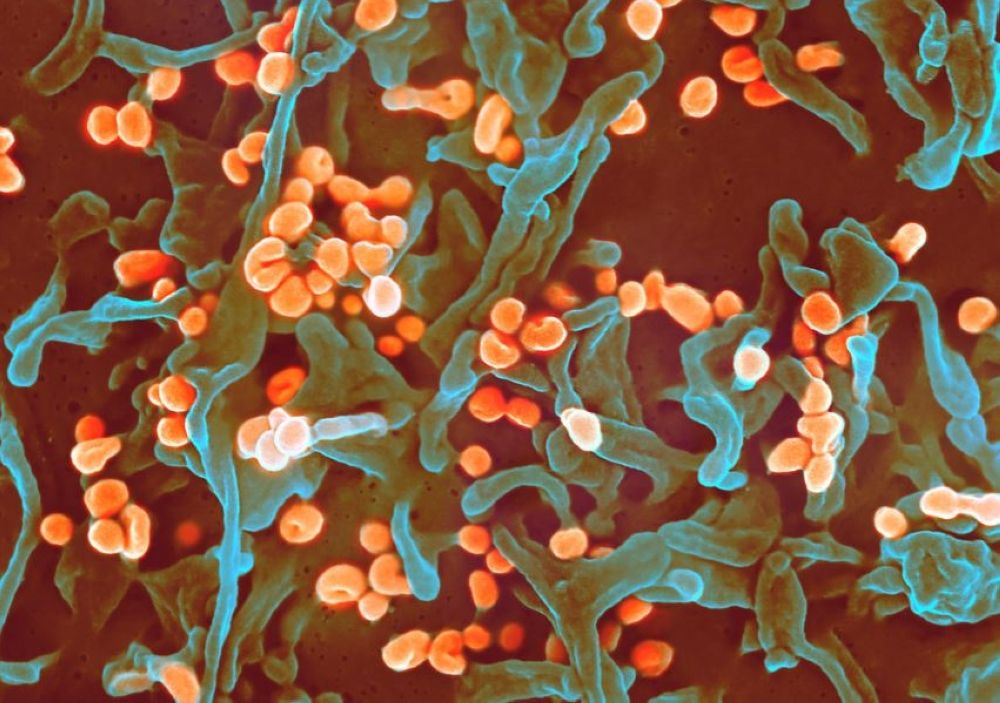 وباء محتمل.. حمى "لاسا" تقتل 190 شخصًا في نيجيريا