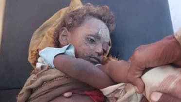 الخليج اليوم .. اليمن..مقتل وإصابة 4 أطفال من أسرة واحدة بقصف حوثي في تعز