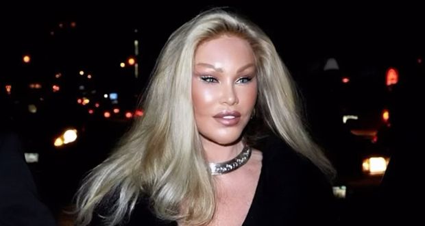 وفاة “المرأة القطة” جوسلين ويلدنشتاين عن 84 عاماً في باريس