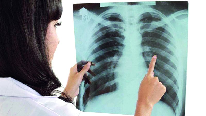 الامارات | باحثون يحذّرون المدخنين: كل سيجارة تقصر حياتك 20 دقيقة