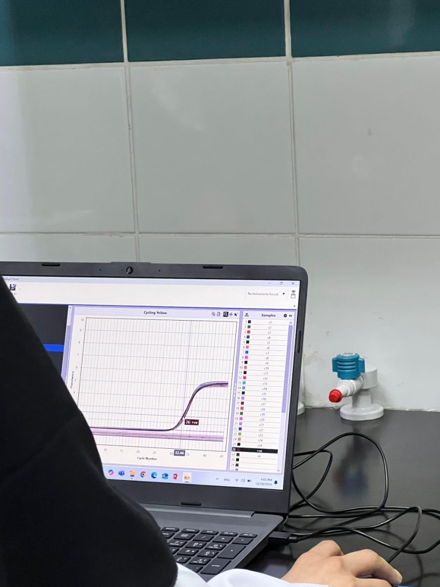 رقابة صحية.. فحص 7 آلاف عينة غذاء بجدة خلال ديسمبر
