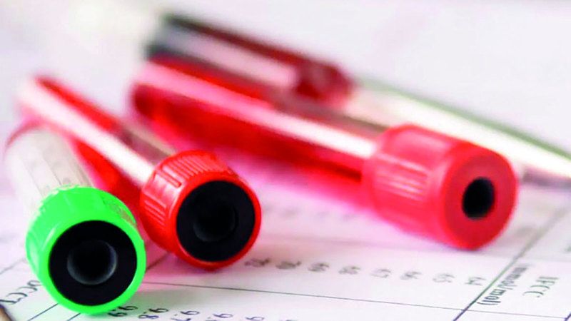 الامارات | توضيح أسباب فقر الدم