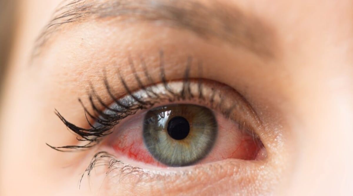 4 نصائح لتجنب جفاف العين.. "شرب الماء" عامل مهم