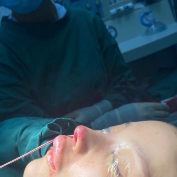 ما هي جلسات الـ«سكين بوستر»؟ تعالج مشكلات البشرة لمدة 6 أشهر