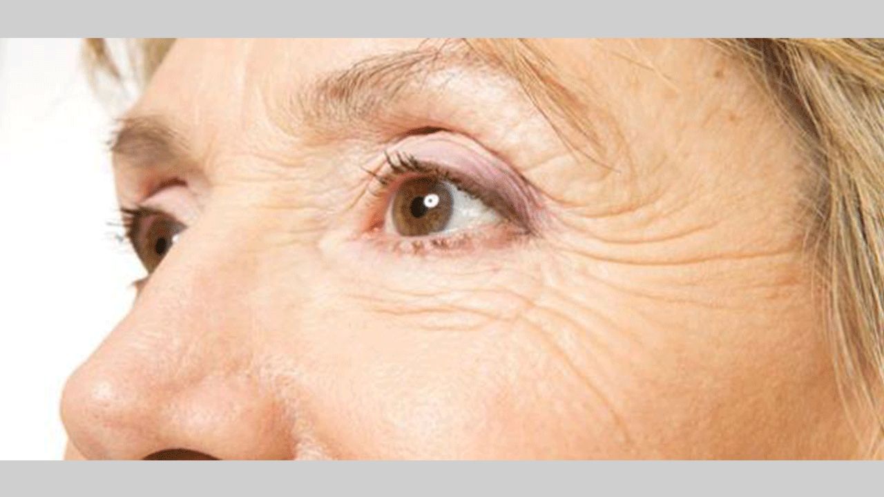 الامارات | أخطاء تسرّع ظهور التجاعيد العميقة ونصائح للوقاية منها