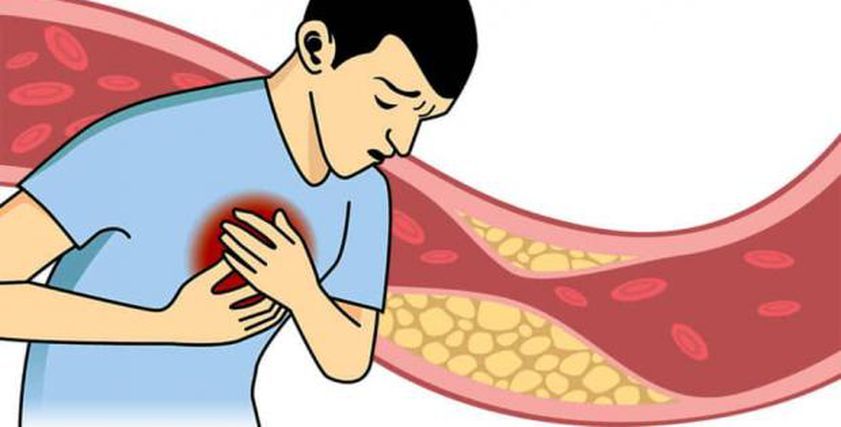 أكلة شتوية تخفض الكوليسترول وتعالج السكر بالدم.. موجودة في كل مكان