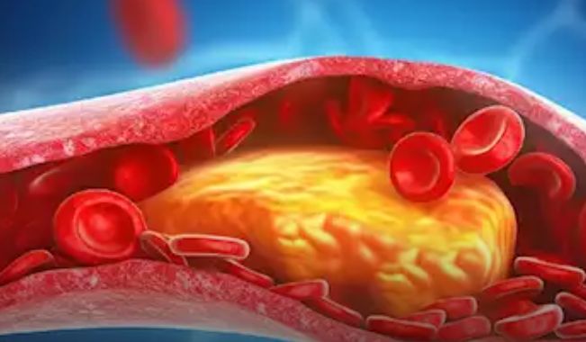 وداعًا للكوليسترول...هذه الوجبة تعالجه في 30 يومًا