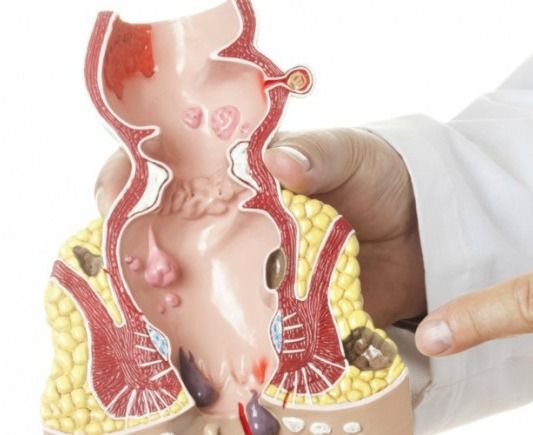 3 مشروبات تزيد خطر الإصابة بمرض ألزهايمر .. ابتعدوا عنها