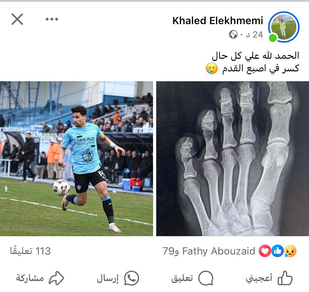 لاعب المحلة يعلن إصابته بكسر فى إصبع القدم وغيابه عن مواجهة الأهلي