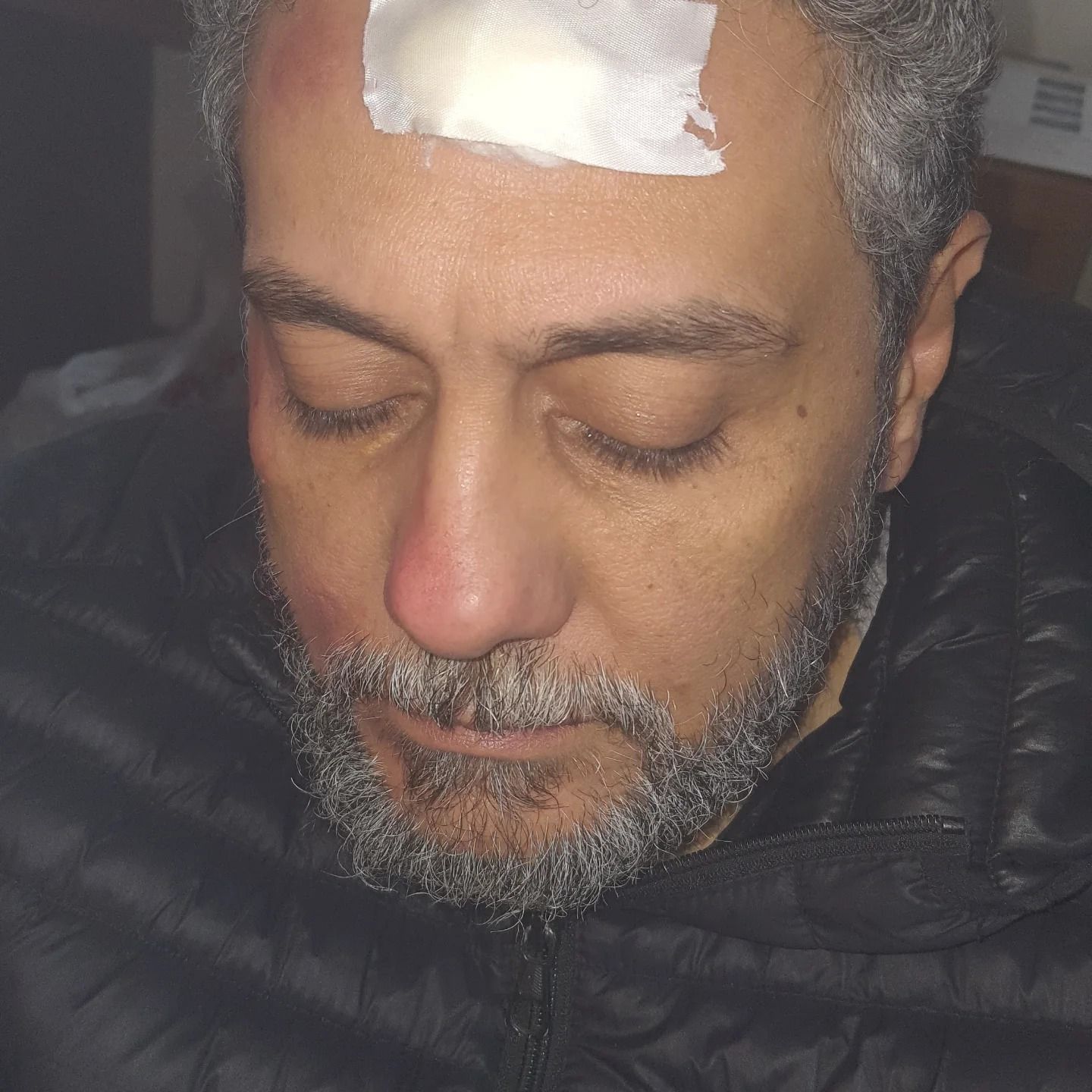 إصابة الفنان تامر فرج بعد سقوط وحدة إضاءة على رأسه أثناء تصوير أحدث أعماله