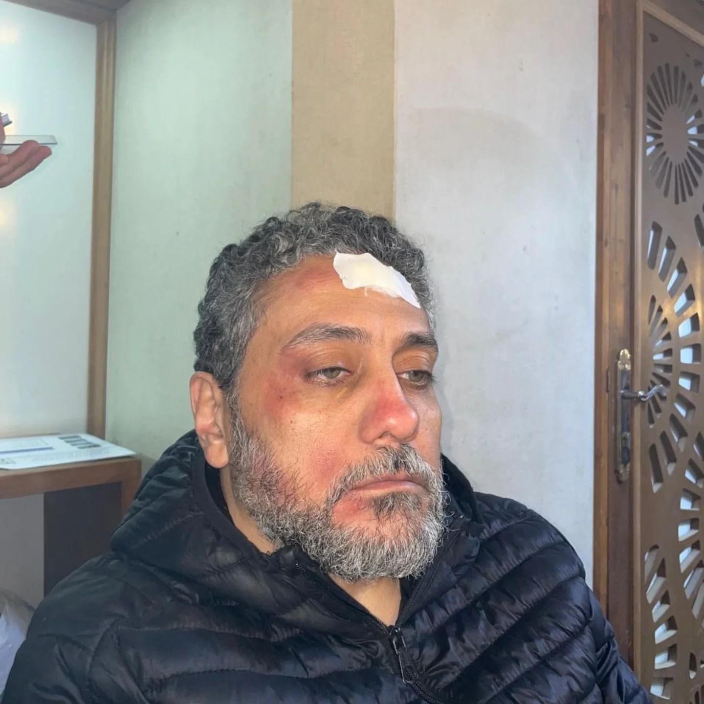 إصابة الفنان تامر فرج بعد سقوط وحدة إضاءة على رأسه أثناء تصوير أحدث أعماله