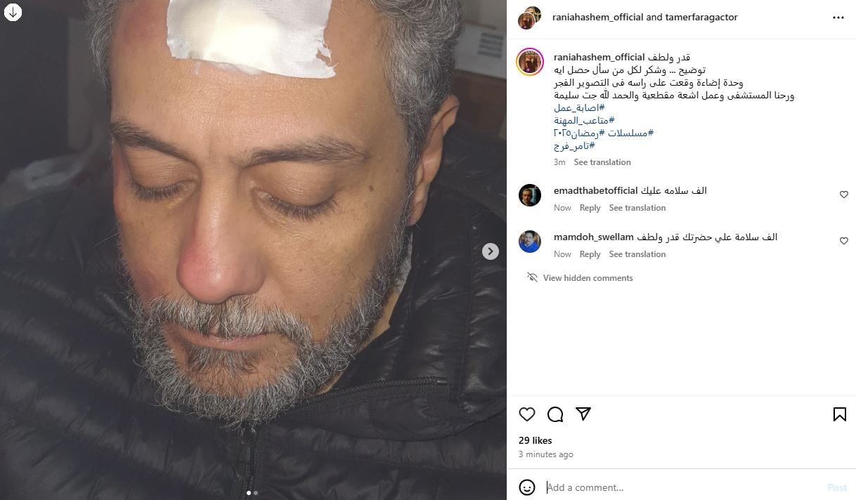 إصابة الفنان تامر فرج بعد سقوط وحدة إضاءة على رأسه أثناء تصوير أحدث أعماله
