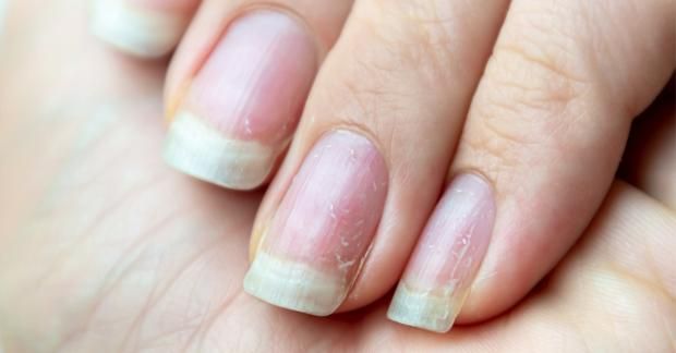 علامات في الأظافر تشير للإصابة بأمراض القلب والكبد.. لا تهملها