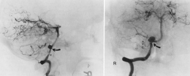 ما هو مرض محمود الخطيب رئيس النادي الأهلي؟ أبكي جمهور الكرة المصرية