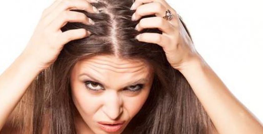 طرق علاج الثعلبة بالزيوت الطبيعية والدواء.. طبيبة تعيد الأمل