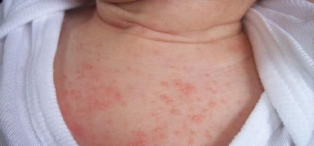 طبيب يكشف عن 6 أعراض خطيرة تظهر على الأطفال.. احذري تجاهلها