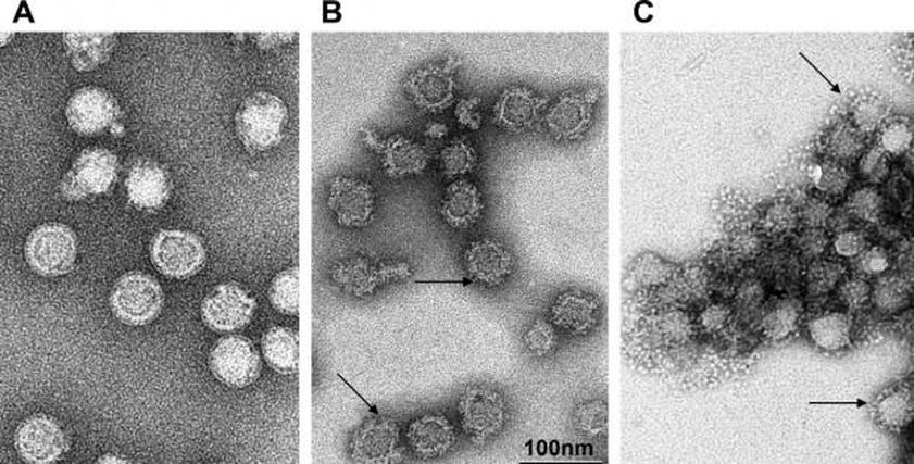 فيروس فتاك يصل بريطانيا يسبب التهاب الدماغ.. أعراضه وكيفية الوقاية