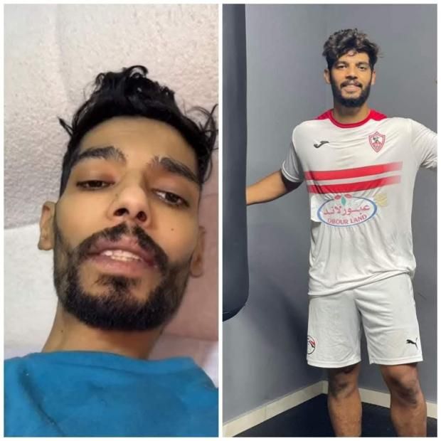 تطورات حالة إبراهيم شيكا لاعب الزمالك المصاب.. «مش قادر يتكلم بسبب السرطان»