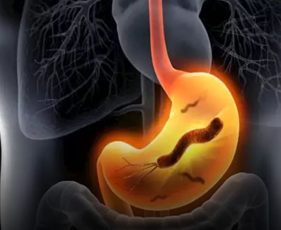 جرثومة المعدة.. كيف تحمي نفسك من إصابتك بها قبل رمضان؟