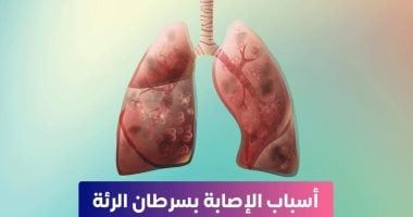 وزارة الصحة تكشف عن أسباب الإصابة بسرطان الرئة.. تفاصيل