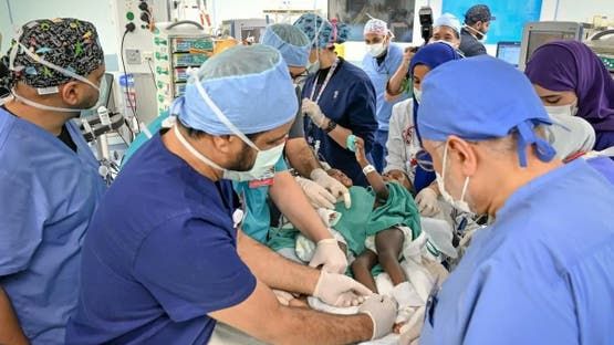 الخليج اليوم .. نجاح عملية فصل التوأم السيامي البوركيني "حوى وخديجة"