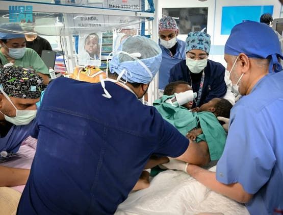 الخليج اليوم .. نجاح عملية فصل التوأم السيامي البوركيني "حوى وخديجة"