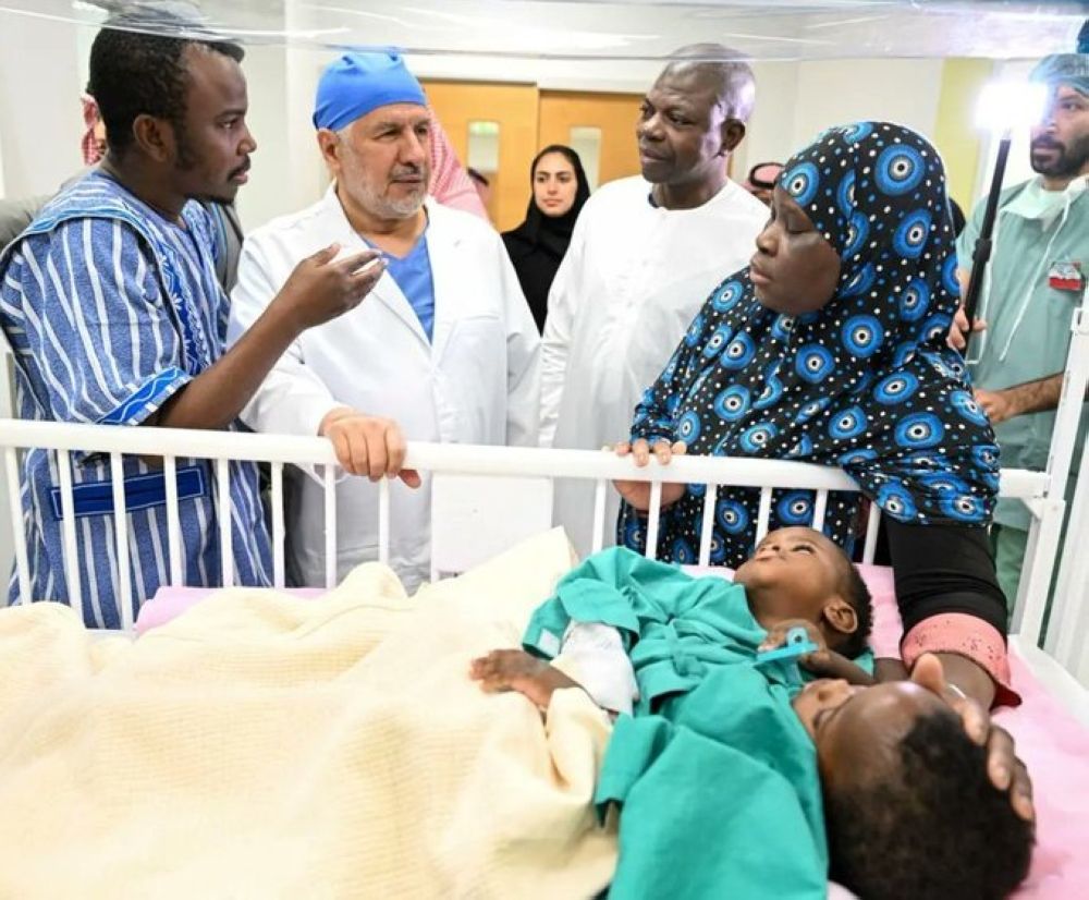 إنفاذًا لتوجيهات القيادة.. بدء عملية فصل التوأم السيامي البوركيني