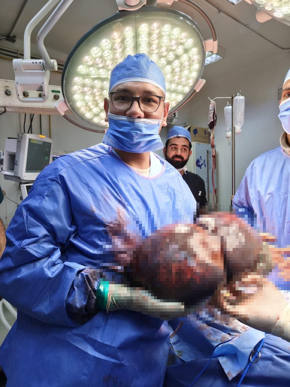 فريق طبى بمستشفى الحسين ينجح فى إجراء عملية دقيقة لاستئصال ورم كبير بالطحال