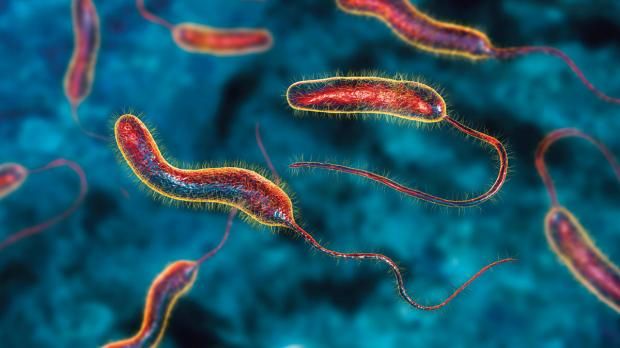 مرض قاتل يثير الرعب في السودان بعد وفاة 70 شخصا في أسبوع.. تعرف على الأعراض