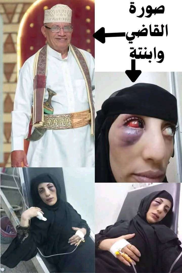 شاهد بالصورة...تعرض ابنة قاضي محكمة بارز لاعتداء مرعب