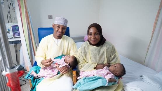 الخليج اليوم .. نجاح أول عملية فصل توأم سيامي في سلطنة عُمان