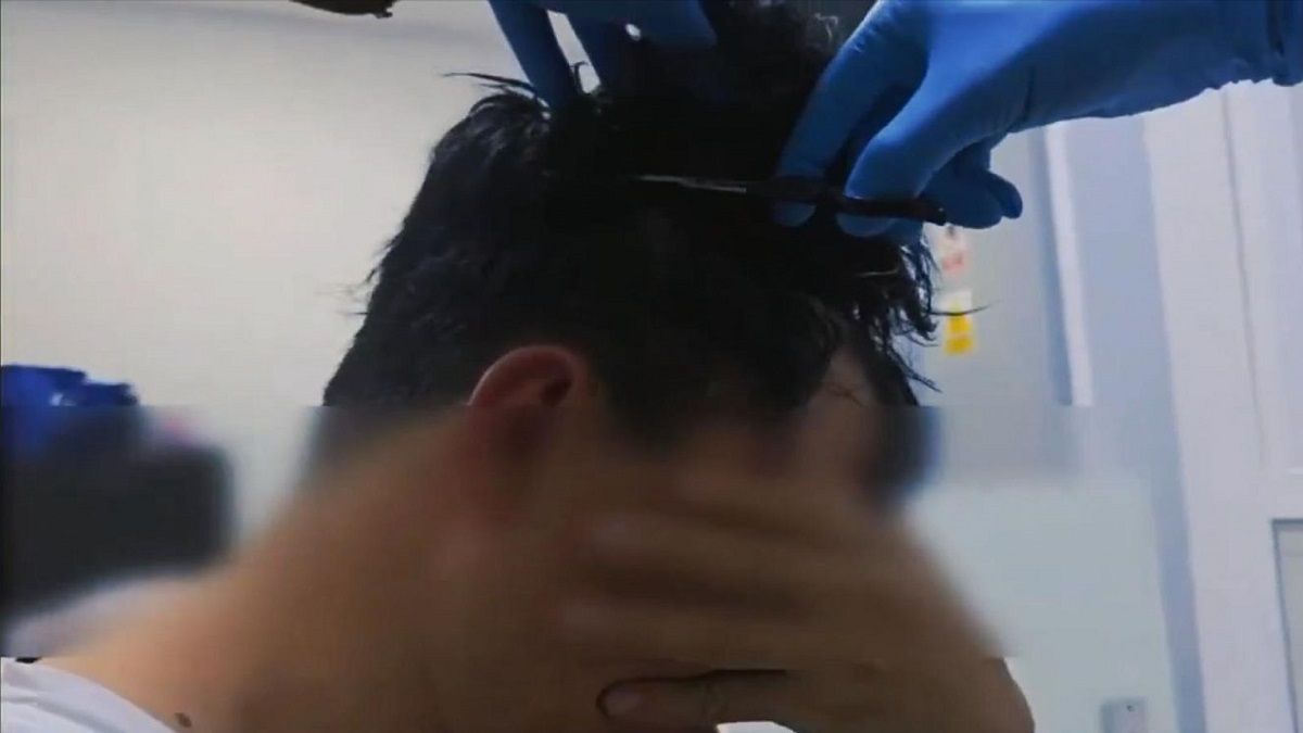 الامارات | القبض علي رجل حاول تهريب المخدرات تحت شعره المستعار
