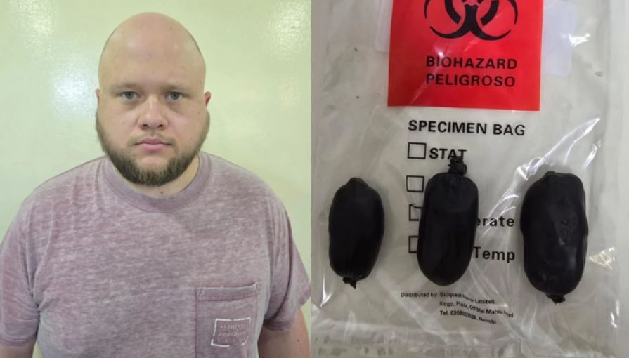 الامارات | أمريكي حاول تهريب مخدرات في أمعائه فكادت تقتله