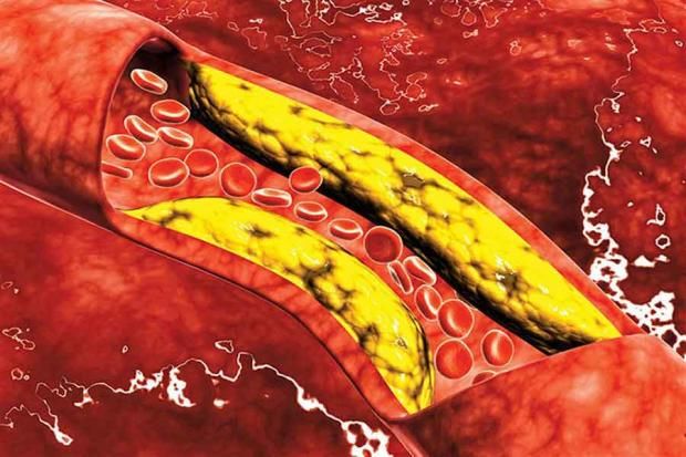 تحذير لمرضى الكوليسترول من شرب القهوة في رمضان.. «خطر على قلبك»