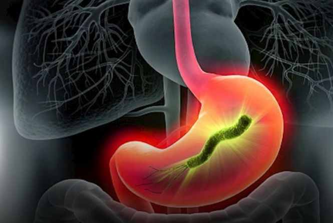 طبيب يحذر من هذه العادة في رمضان: تسبب جرثومة المعدة