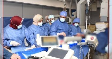 مستشفيات جامعة عين شمس تجرى 20 حالة ناجحة لزراعة الصمام الرئوى بالقسطرة
