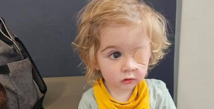 طفل بريطاني يفقد البصر بسبب قبلة.. كيف تحمي أبناءك من الهربس؟