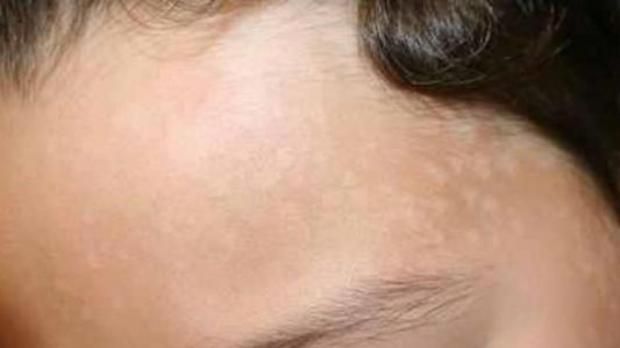 «وجهك مرآة لصحتك».. علامات على الوجه تكشف أمراضا خطيرة في الكبد والكلى