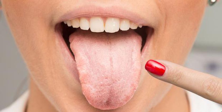 علامات على اللسان تشير إلى الإصابة بأمراض الكبد والمرارة.. راقبها جيدا