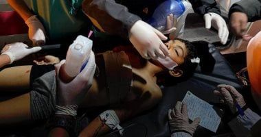 ارتفاع عدد شهداء غارات الاحتلال الإسرائيلى إلى 310 فلسطينيين