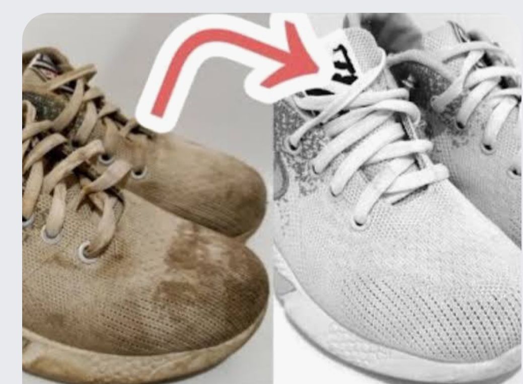 هيرجع زي الجديد.. تنظيف الكوتشي الابيض من الاصفرار والبقع الصعبة في ثواني بمكون سحري