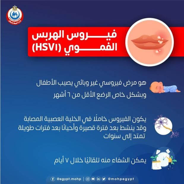 متى يتحول الهربس إلى خطر صحي حقيقي؟ طبيب يحذر من المضاعفات الخطيرة