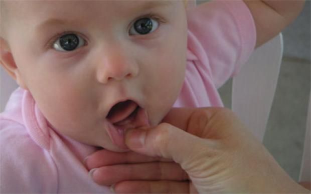 العناية بأسنان الأطفال تبدأ قبل ظهورها.. طرق بسيطة تحمي ابنك من التسوس