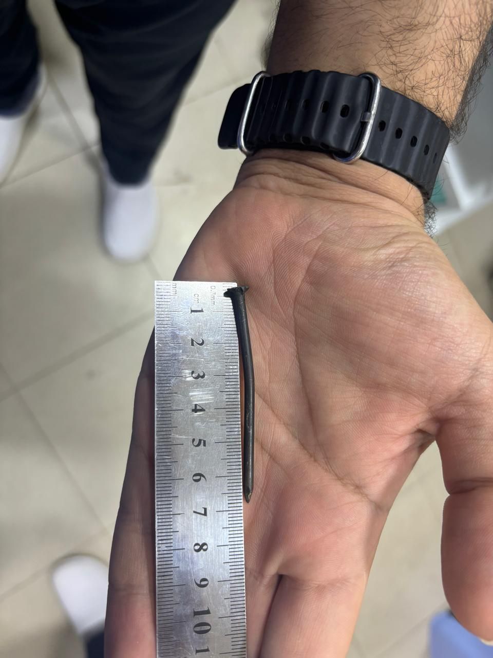 فريق طبى بمستشفى الوراق المركزى يستخرج مسمارا بطول7سم من أمعاء طفل عمره سنتان..صورة