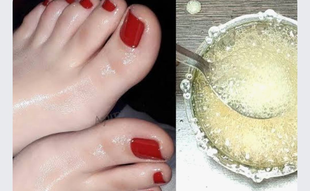خلطة الخل الرهيبة لتقشير القدمين وإزالة الجلد الميت والقشور في دقائق
