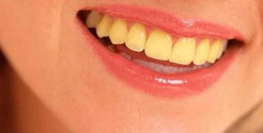 عادات خطيرة تدمر صحة الأسنان في رمضان.. بينها مضغ مكعبات الثلج