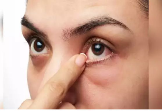 علامة في عينيك...تنذر باقتراب إصابتك بسكتة دماغية