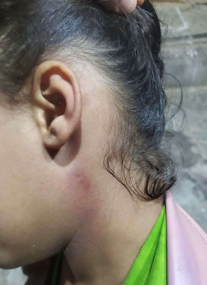 بالصورة تعرض طفلة لمحاولة اغتصاب والامن يطلق سراح الجاني