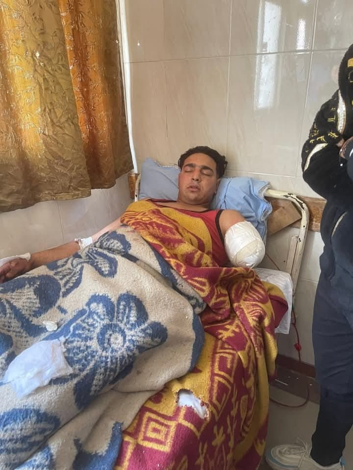 ننشر أول صورة لعامل سيرك طنطا بعد بتر ذراعه داخل مستشفى جامعة طنطا